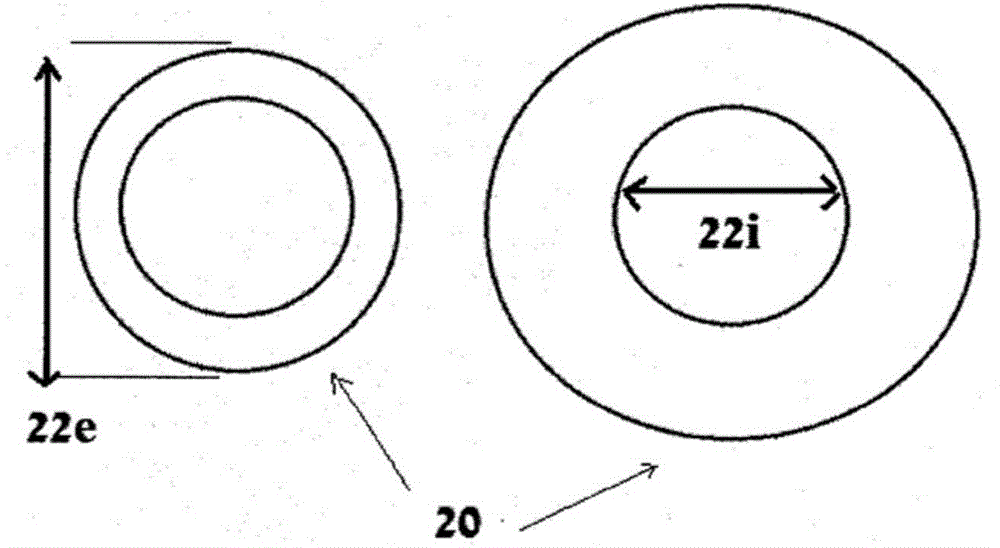 Single ring heart valve support structure