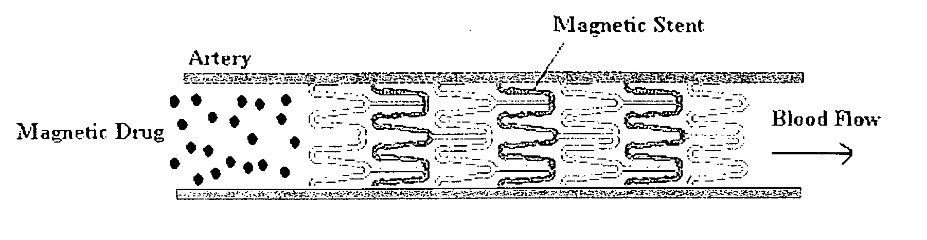 Magnetically-controllable delivery system for therapeutic agents