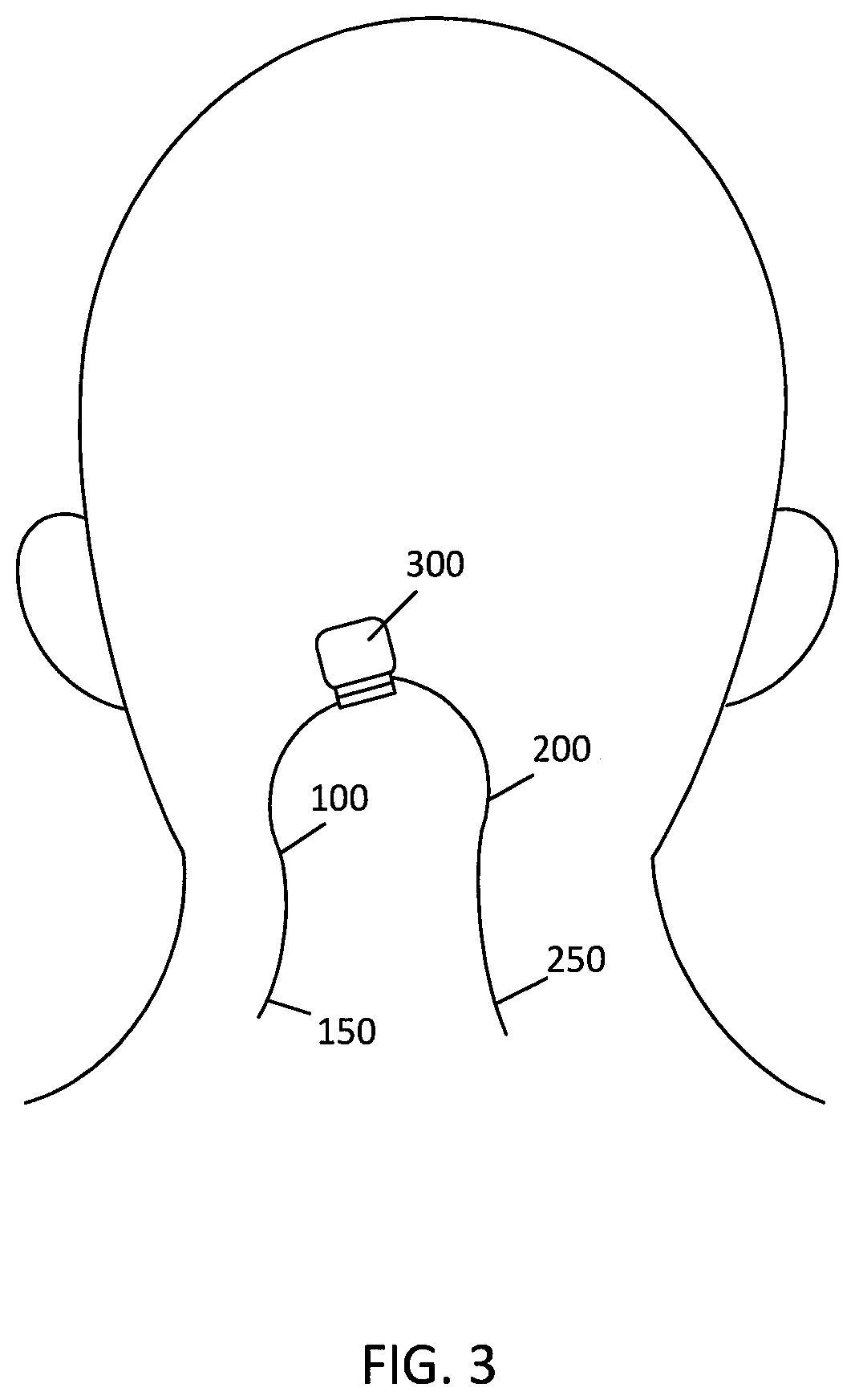 Neurostimulators and stimulation systems