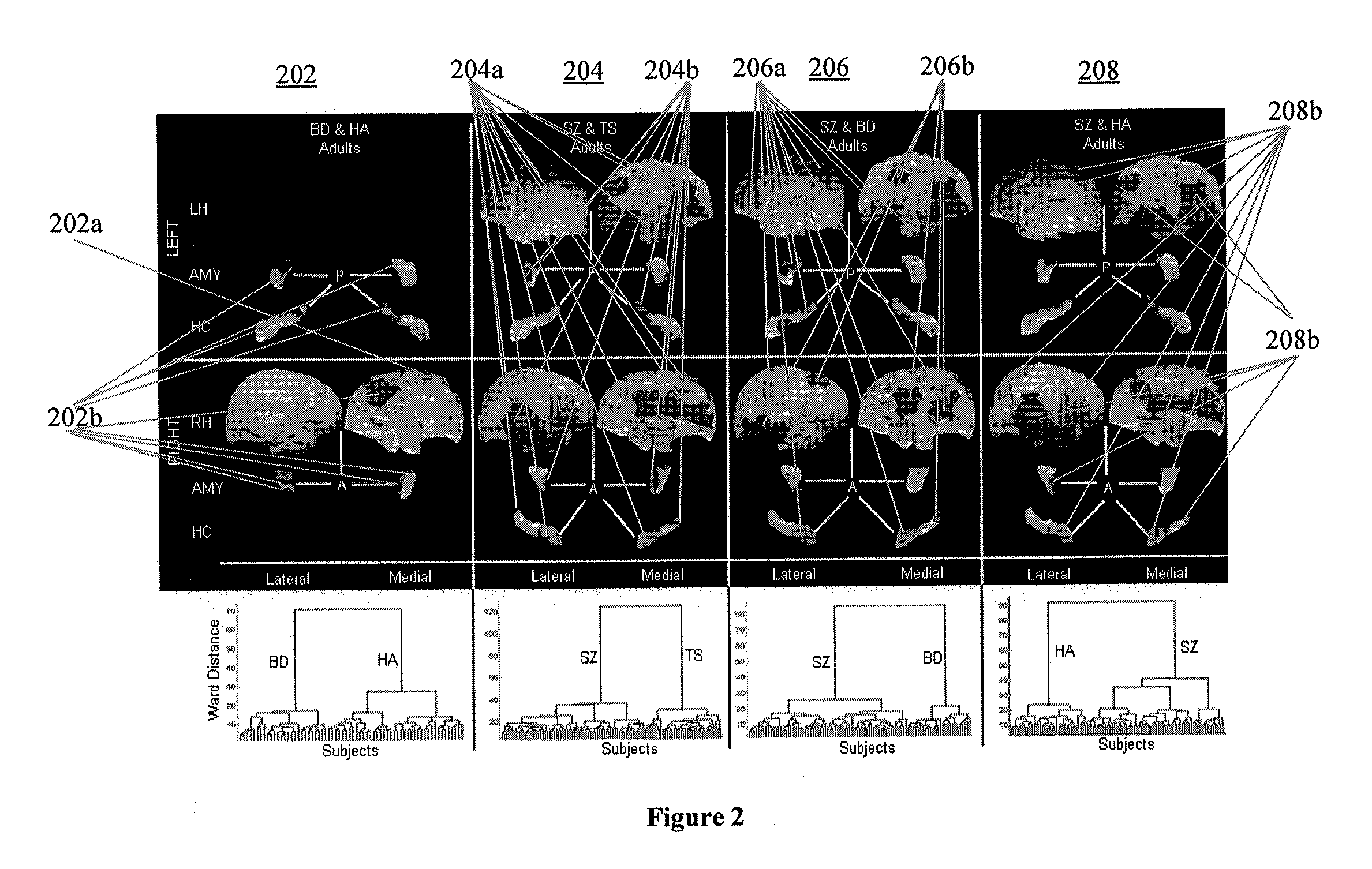 Apparatus, method and computer-accessible medium for diagnosing and subtyping psychiatric diseases