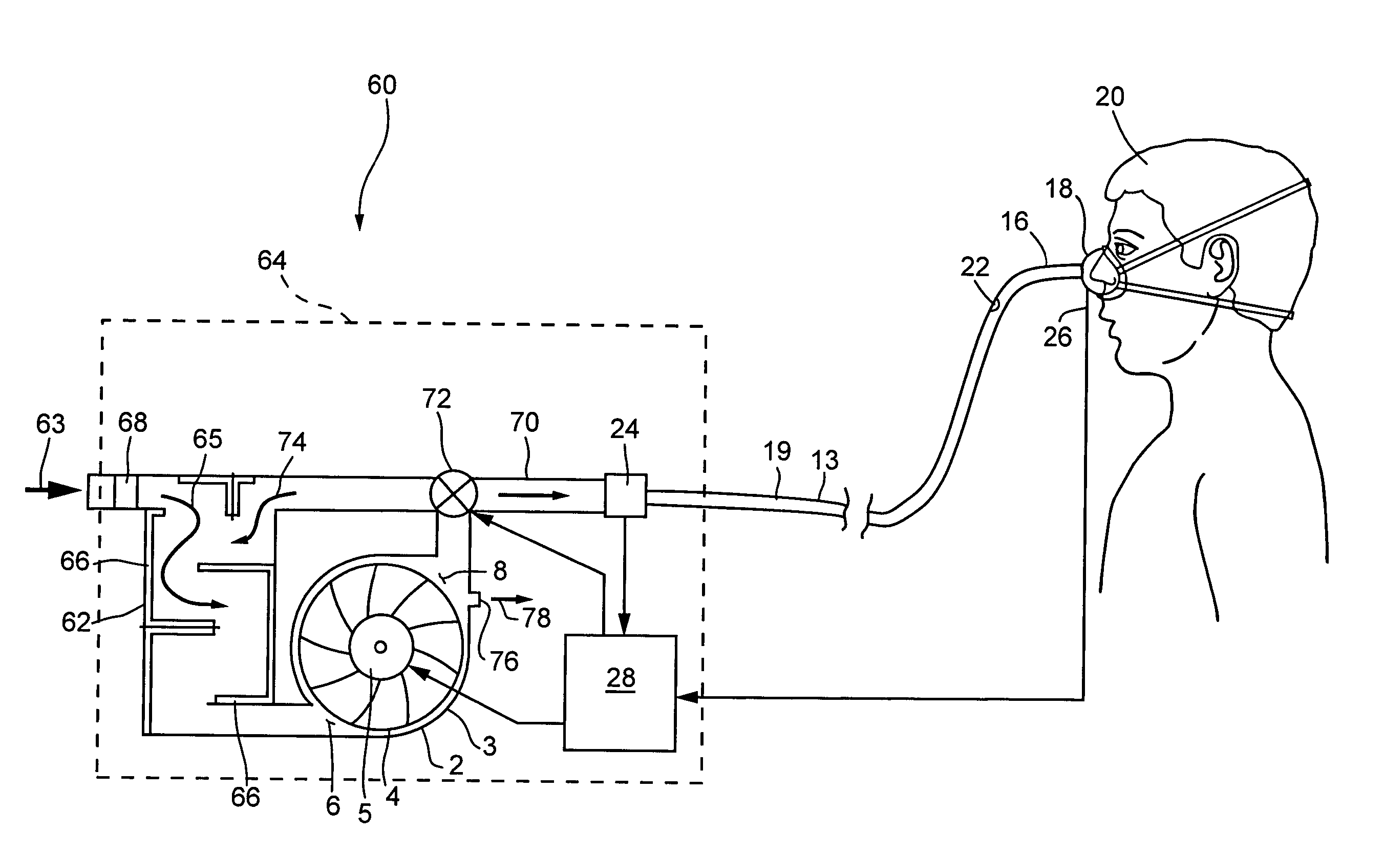 Pressure support system and method and a pressure control valve for use in such a system and method