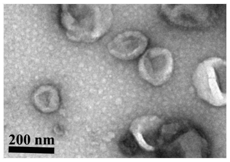 Application of marker based on TAZ level of single exosome transcription factor in serum in preparation of diagnosis for treating lung cancer