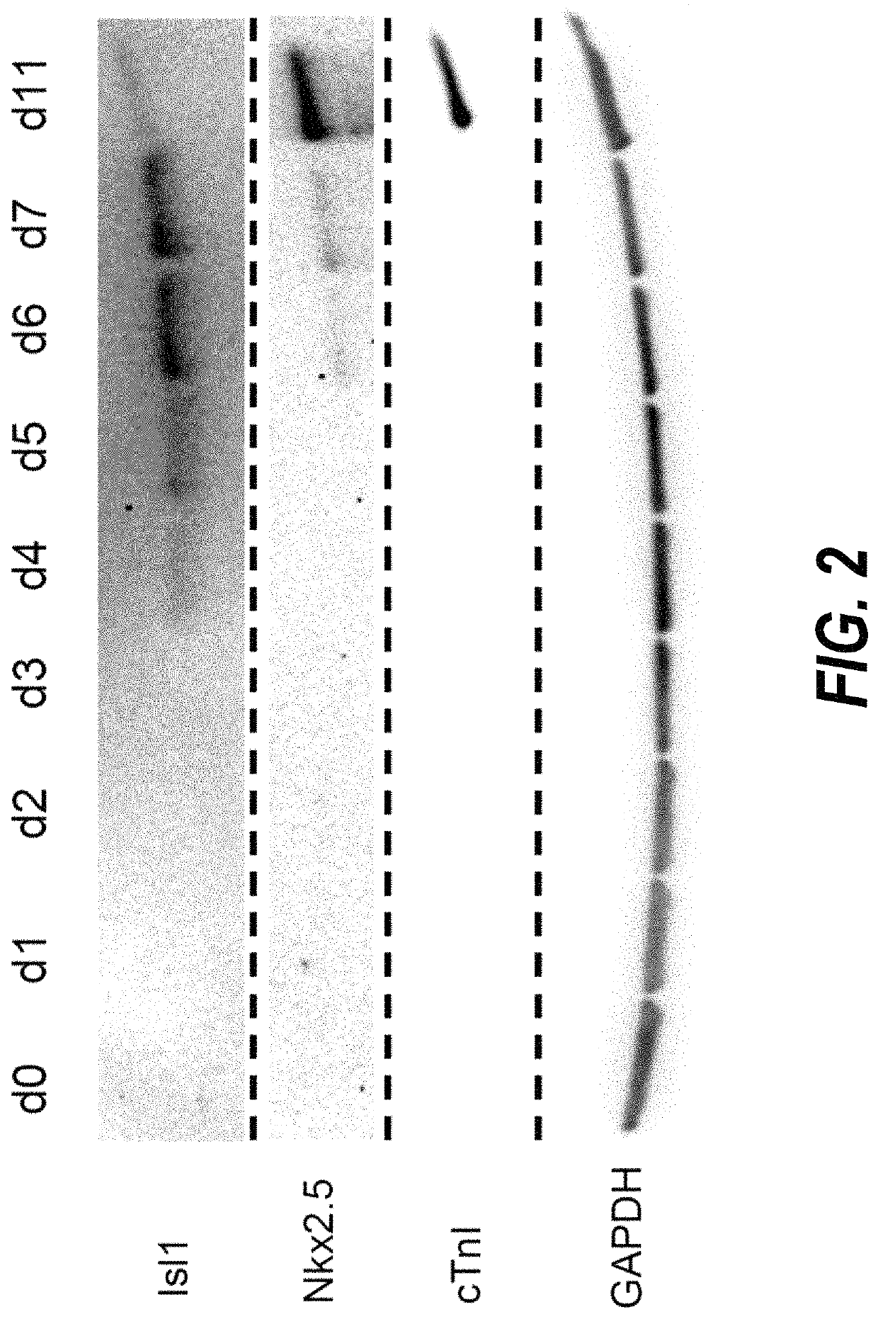 Methods for isolating human cardiac ventricular progenitor cells