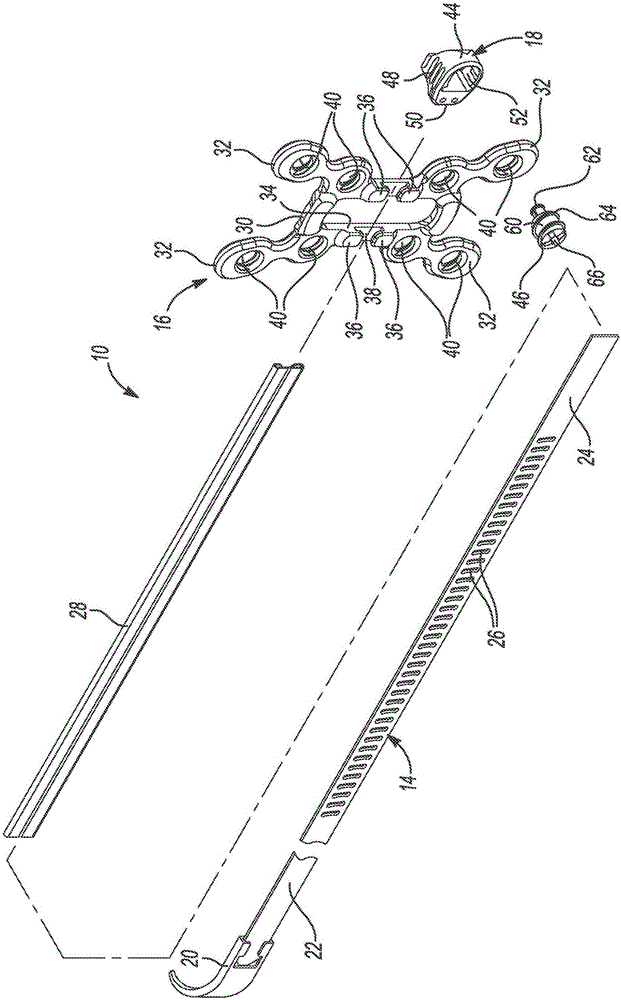 Sternal closure cerclage, plate implant and instrumentation