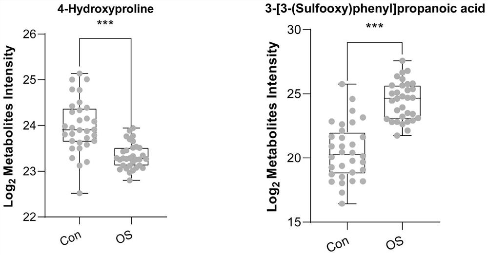 Anion diagnosis marker for osteoporosis and detection method thereof