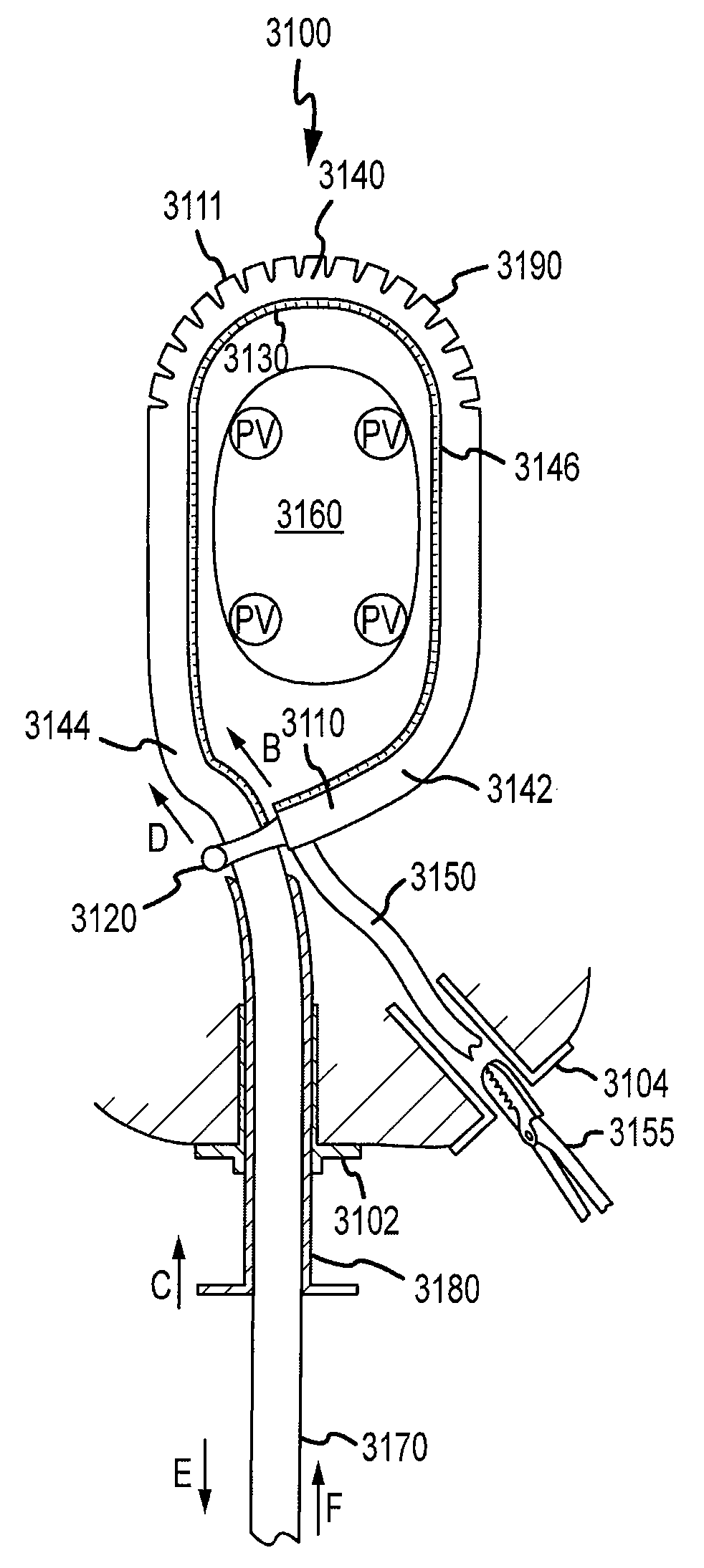 Cardiac ablation systems and methods