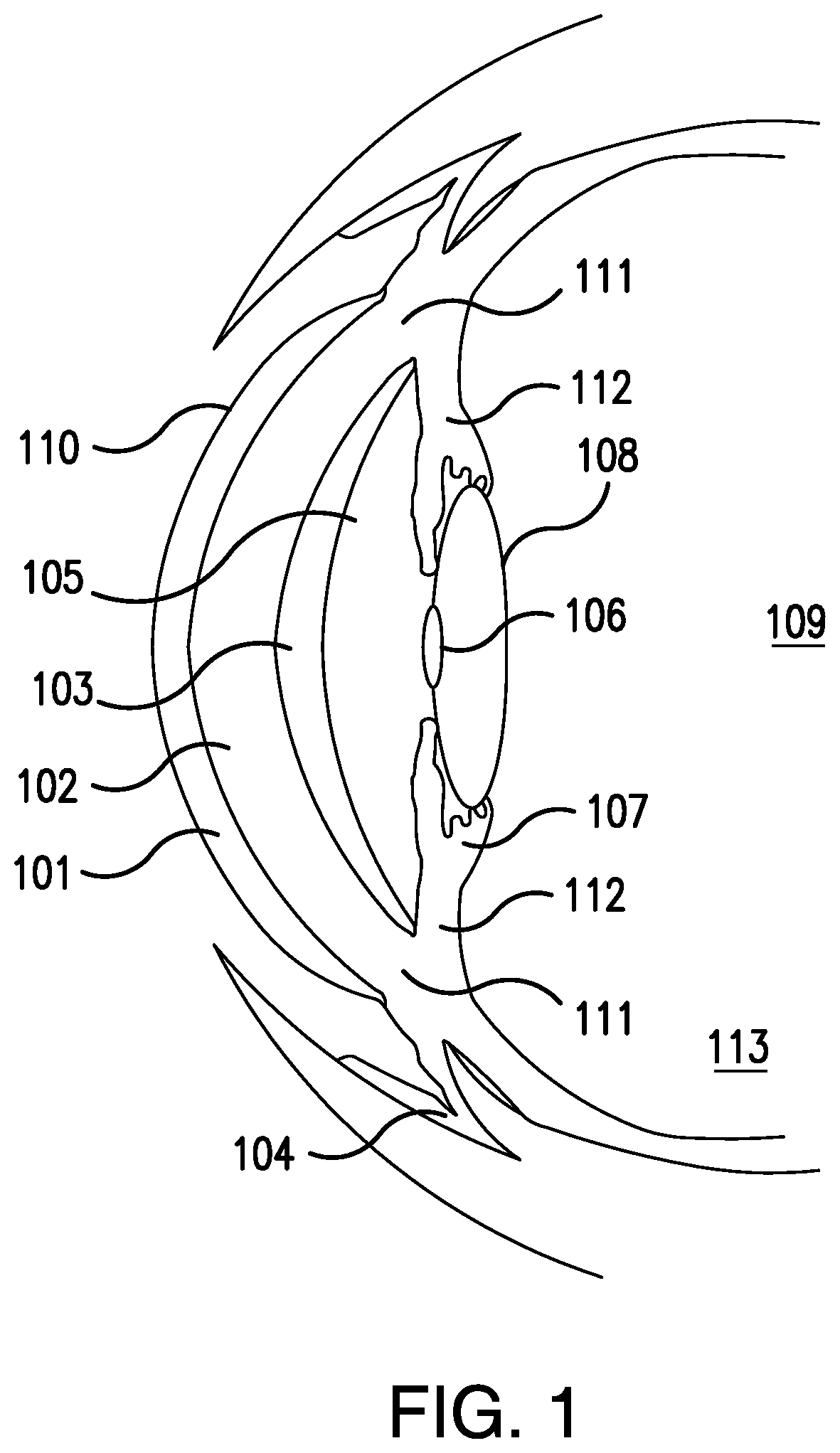 Methods for ophthalmic delivery of roflumilast