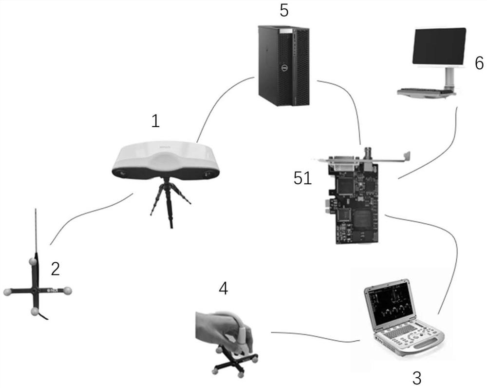 Surgical navigation system for ultrasonically guiding thermal ablation of thyroid tumors