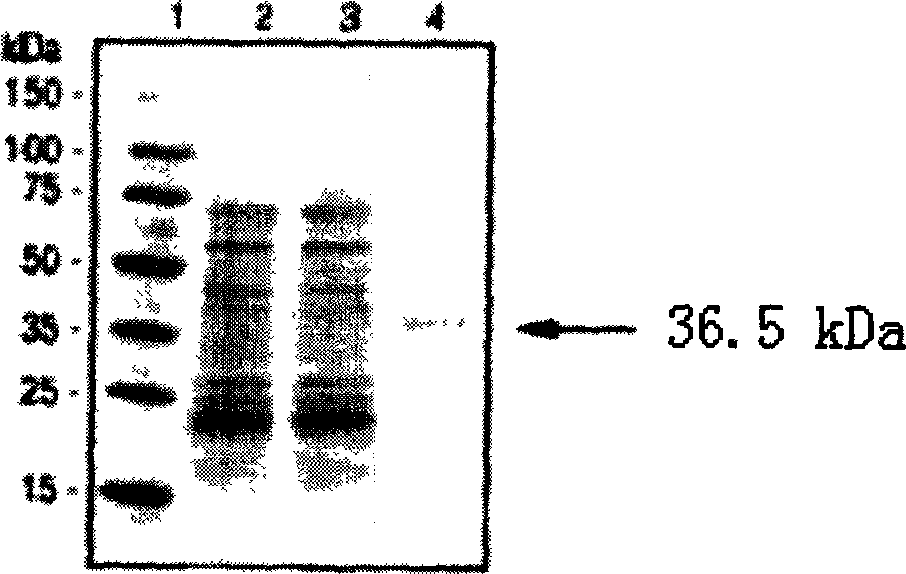 Thermostable type cytoplasm malic dehydrogenase of clonorchis sinensis, its coding nucleic acid and application