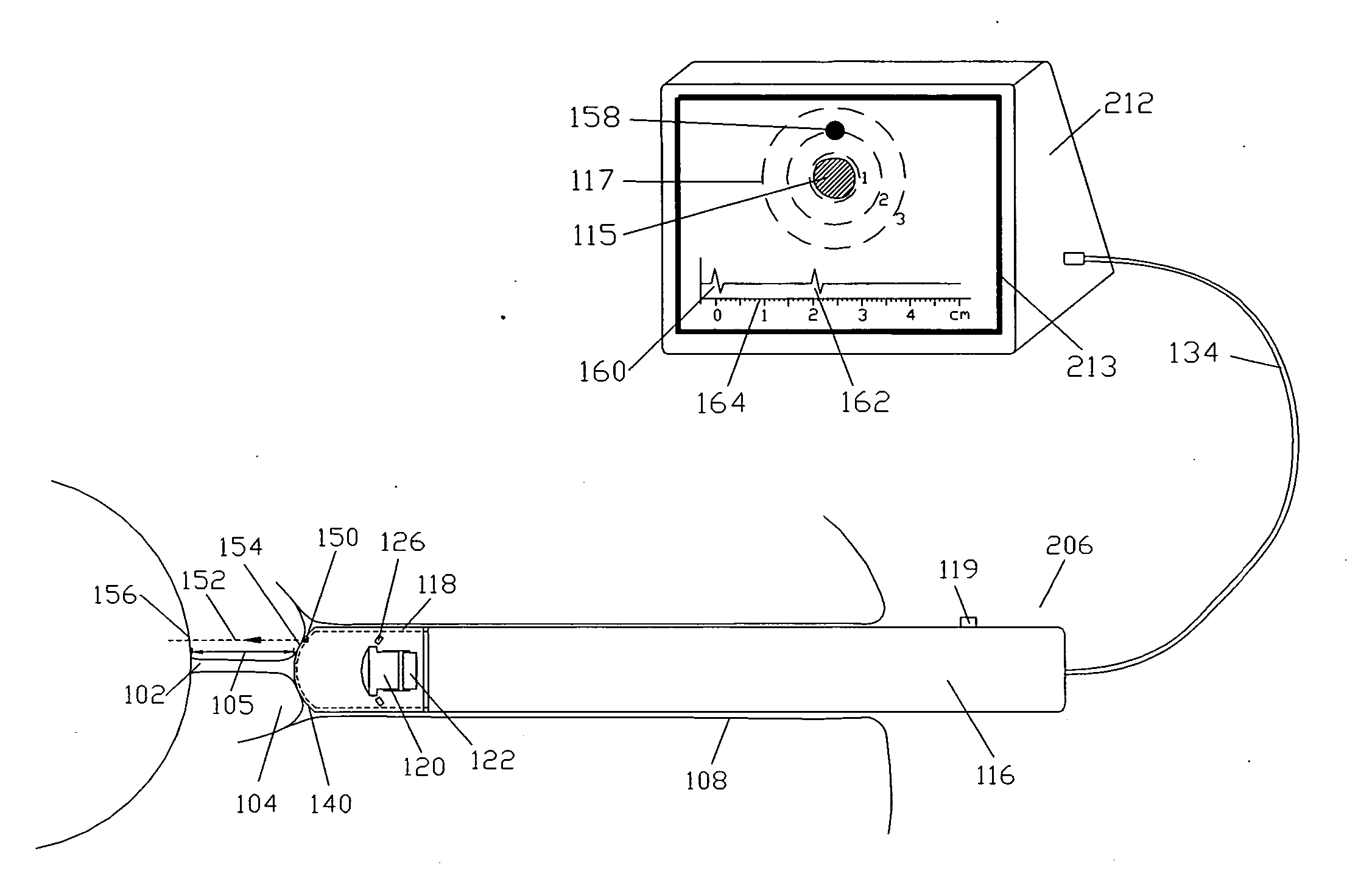 Methods and devices for cervix measurement