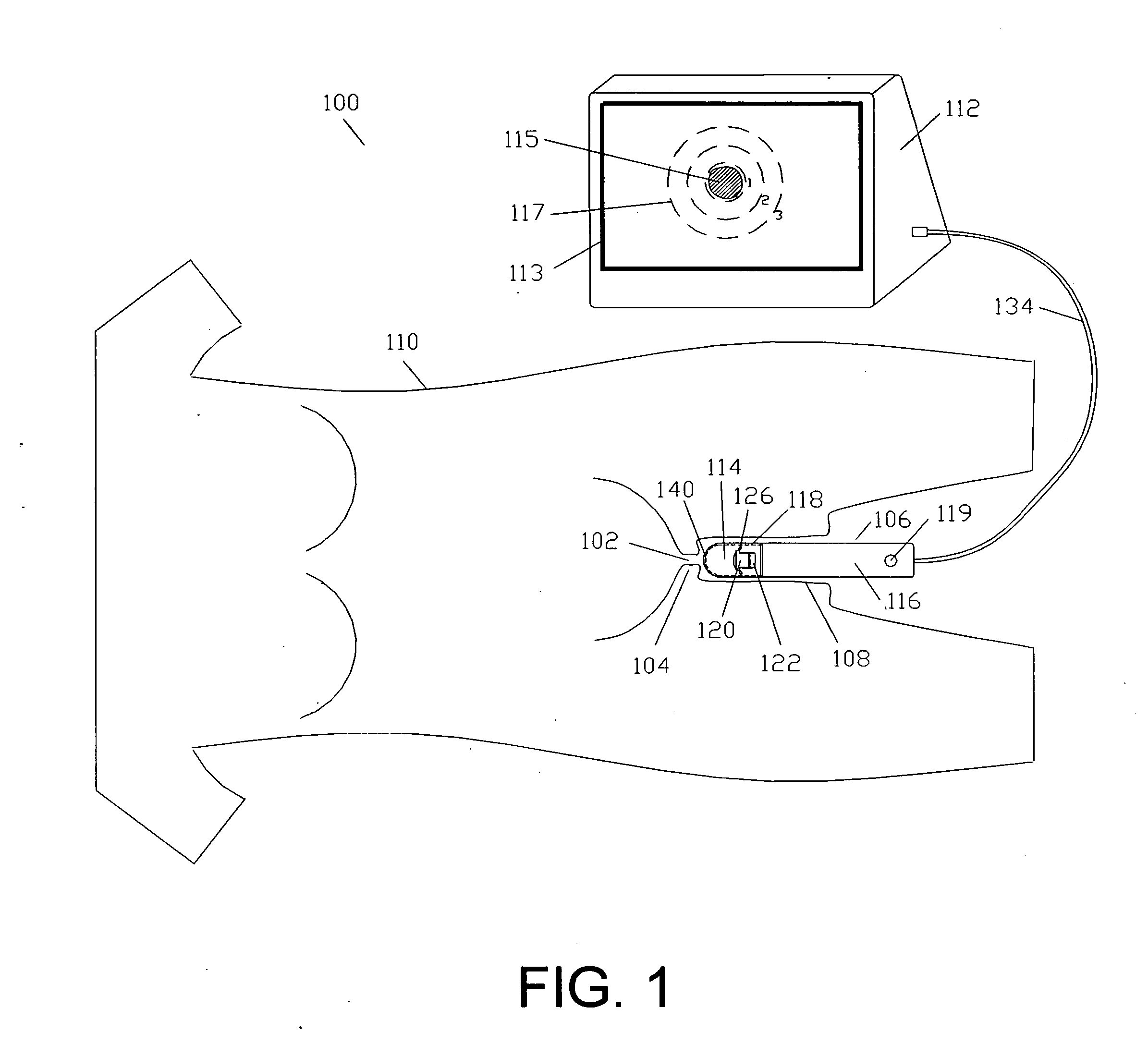 Methods and devices for cervix measurement