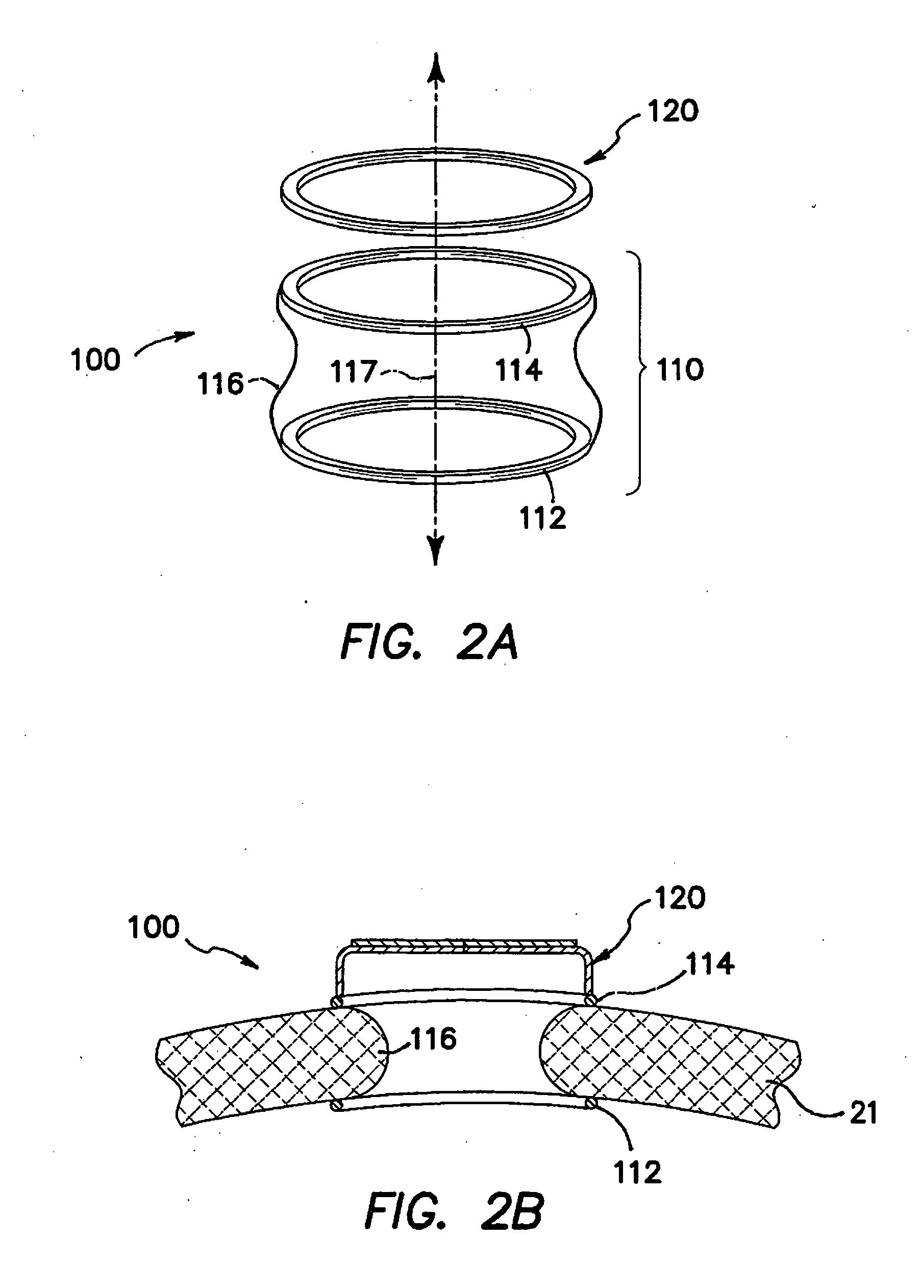 Surgical access system