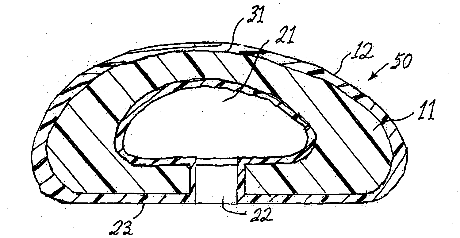 Leak-proof breast implant