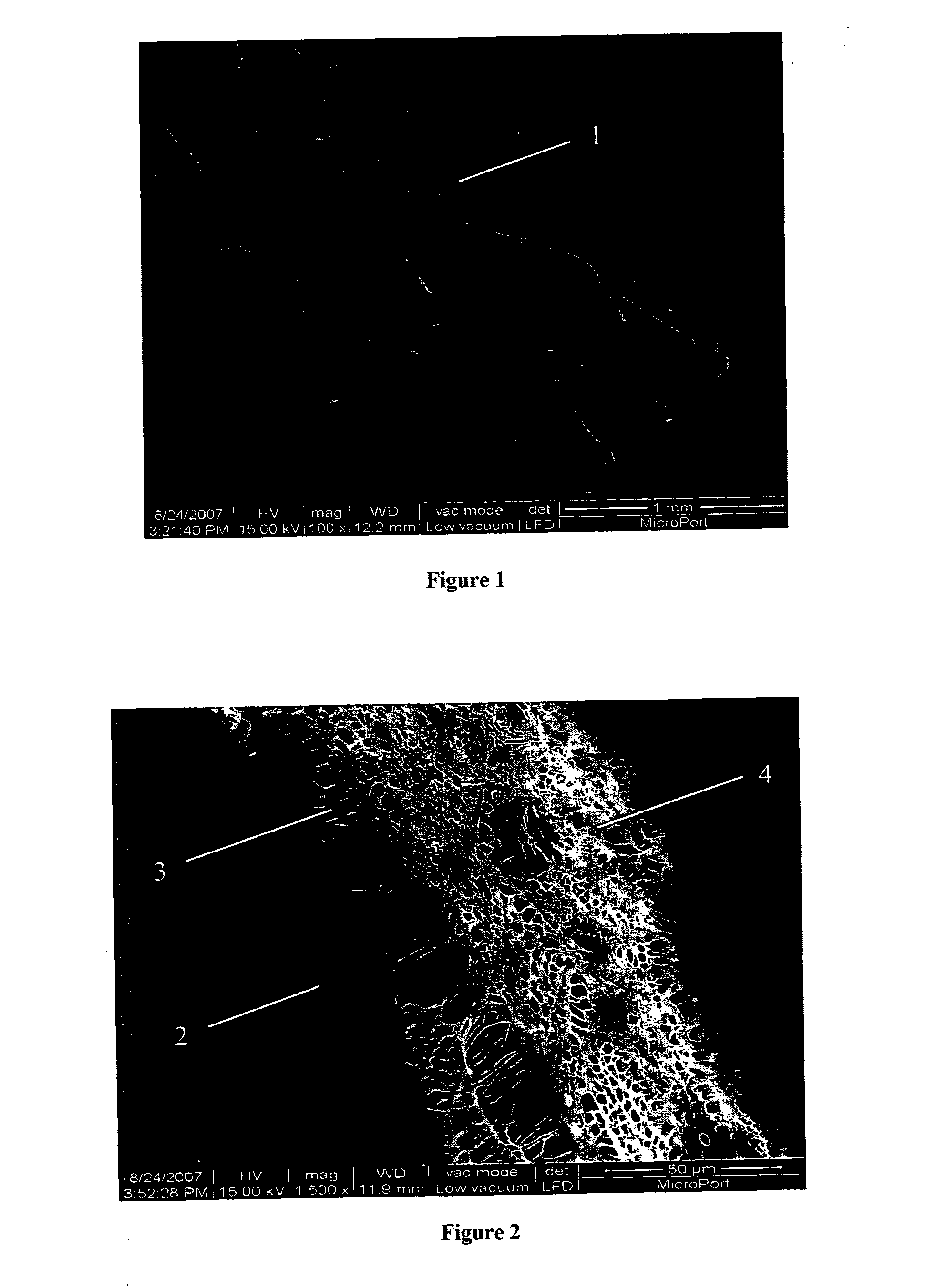 Artificial stent and its preparation method