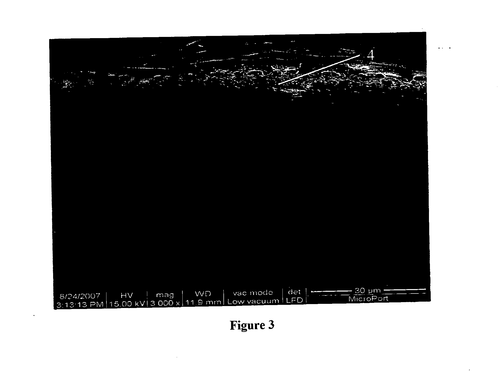 Artificial stent and its preparation method