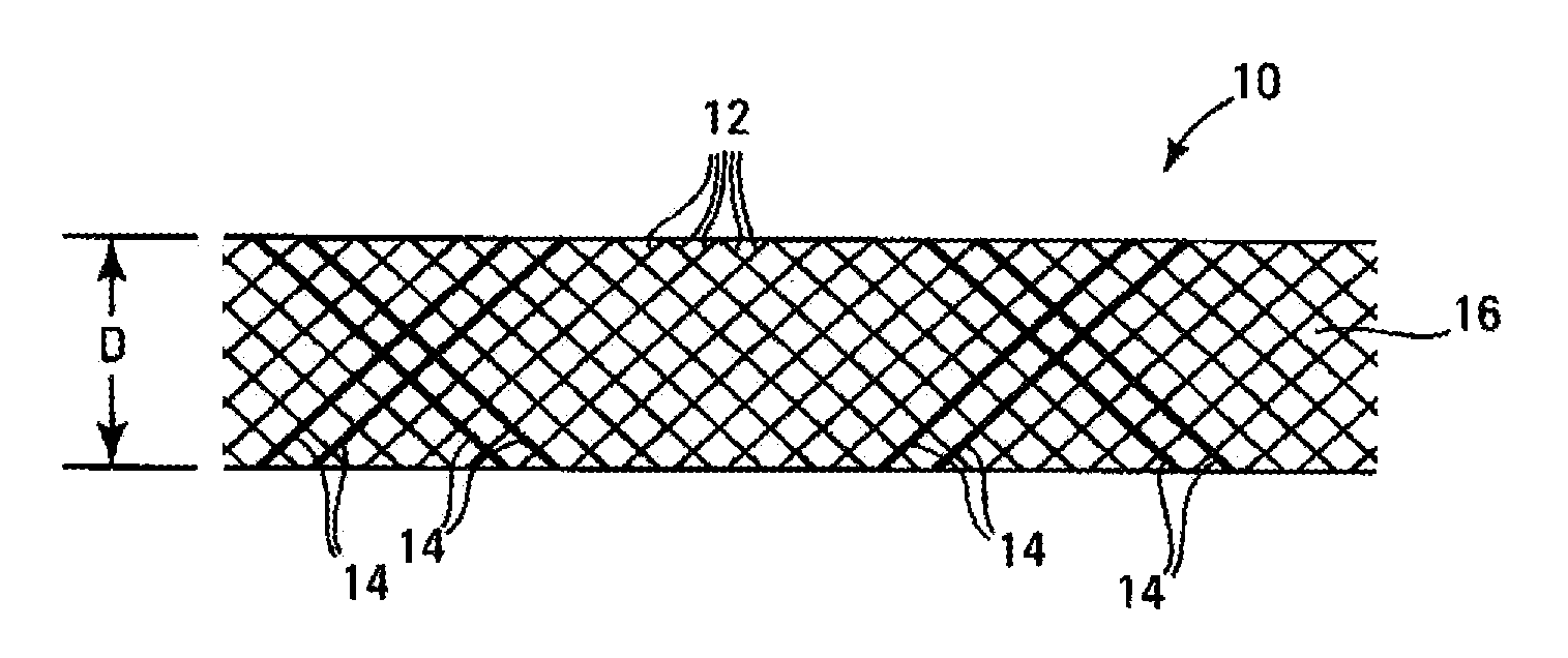 Stents having radiopaque mesh