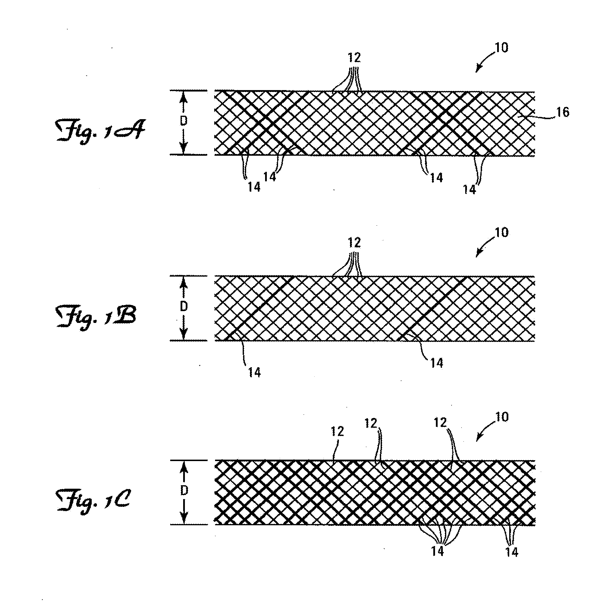 Stents having radiopaque mesh