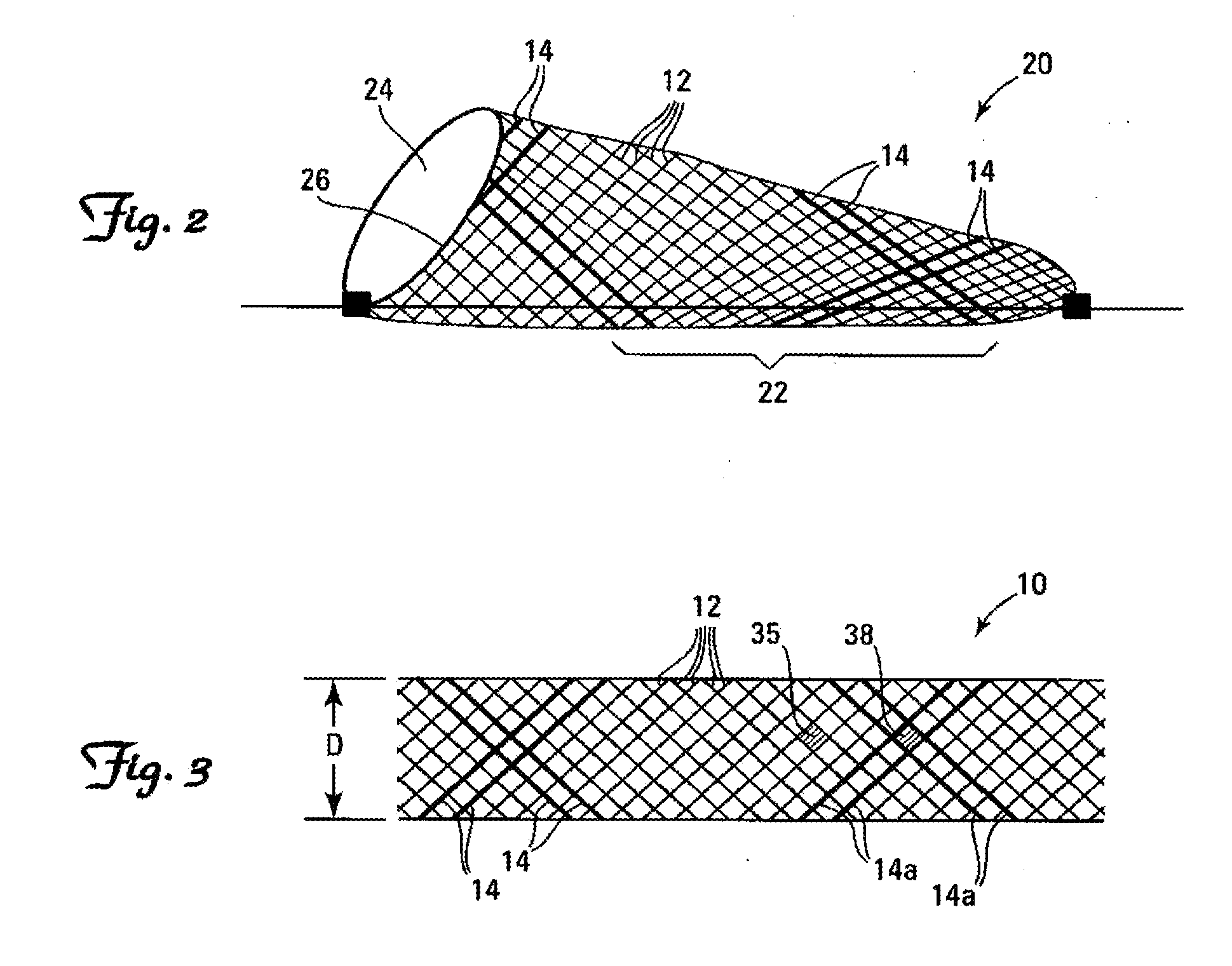 Stents having radiopaque mesh