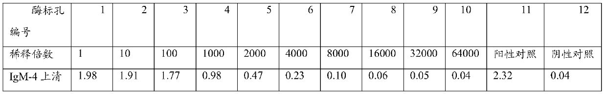 Anti-human igm monoclonal antibody, its hybridoma cell line and application