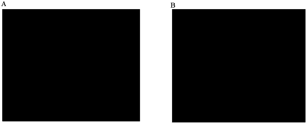 Acellular cartilage matrix and preparation method thereof