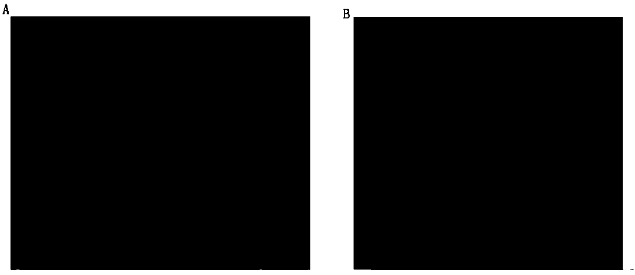 Acellular cartilage matrix and preparation method thereof