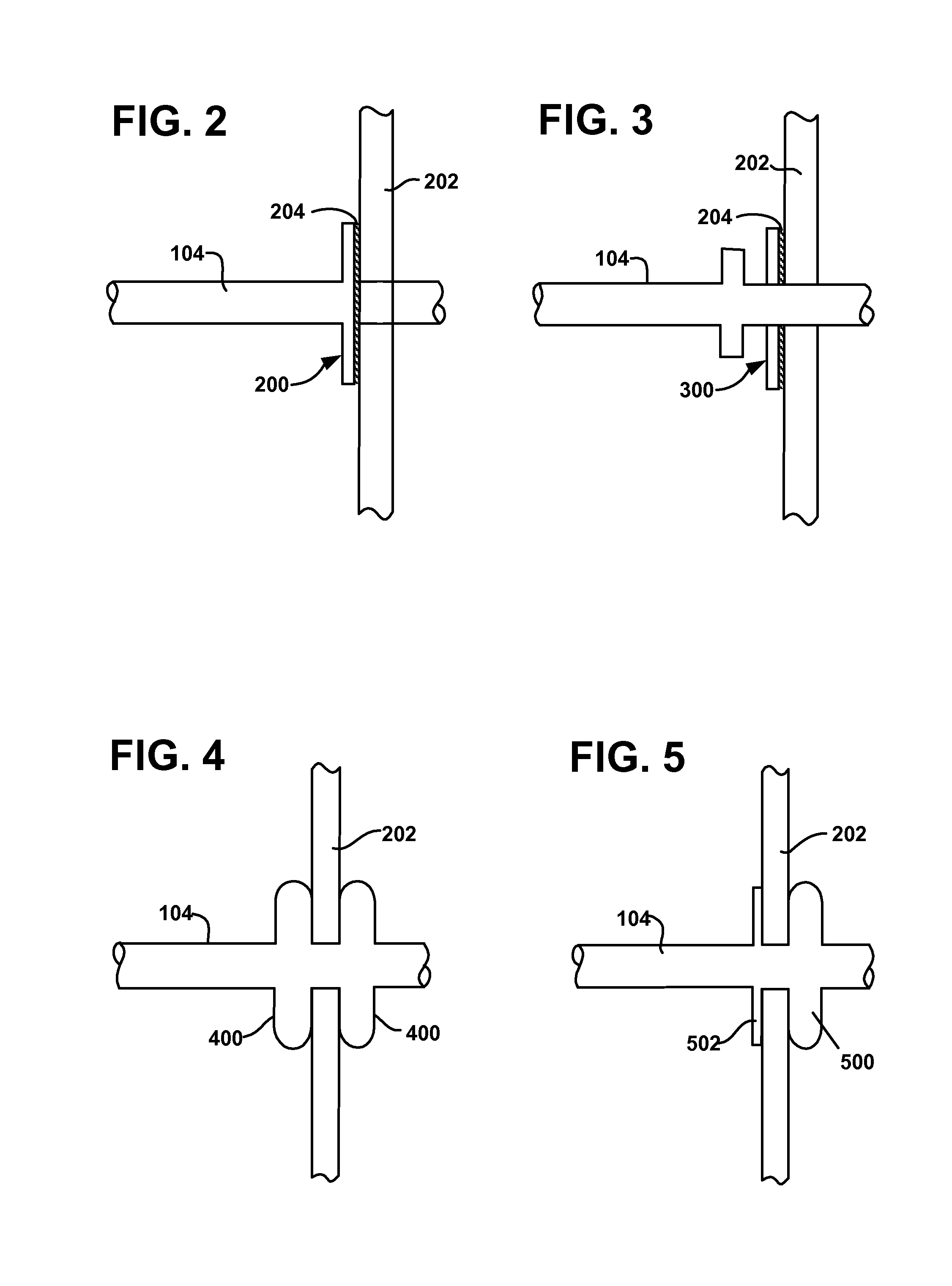 Pulmonary visceral pleura anastomosis reinforcement