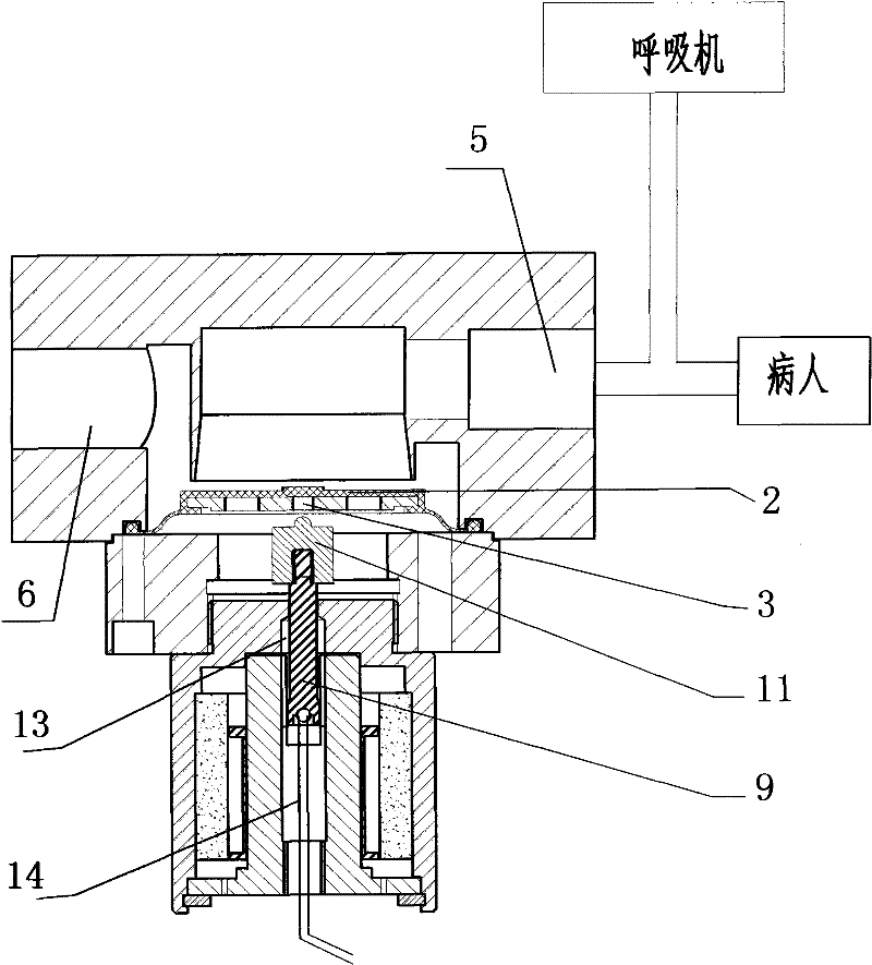 Microprocessor controlled expiratory valve