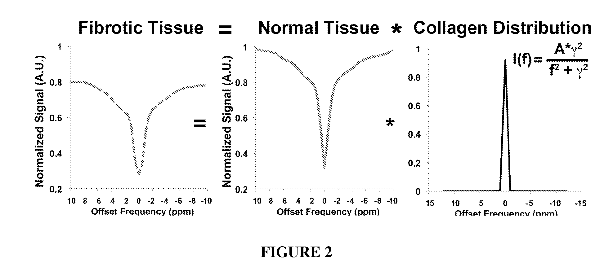 Magnetic resonance imaging for detecting cardiac diseases