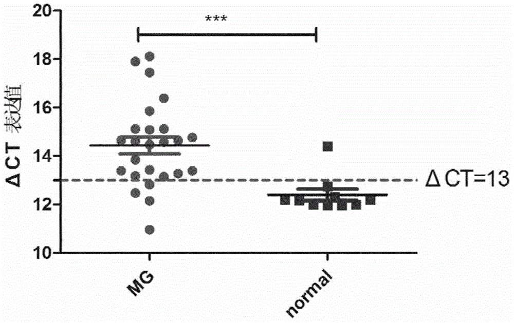 Myasthenia gravis detection kit with non-coding RNA Tmevpg1 as detection or diagnosis screening marker and application of kit