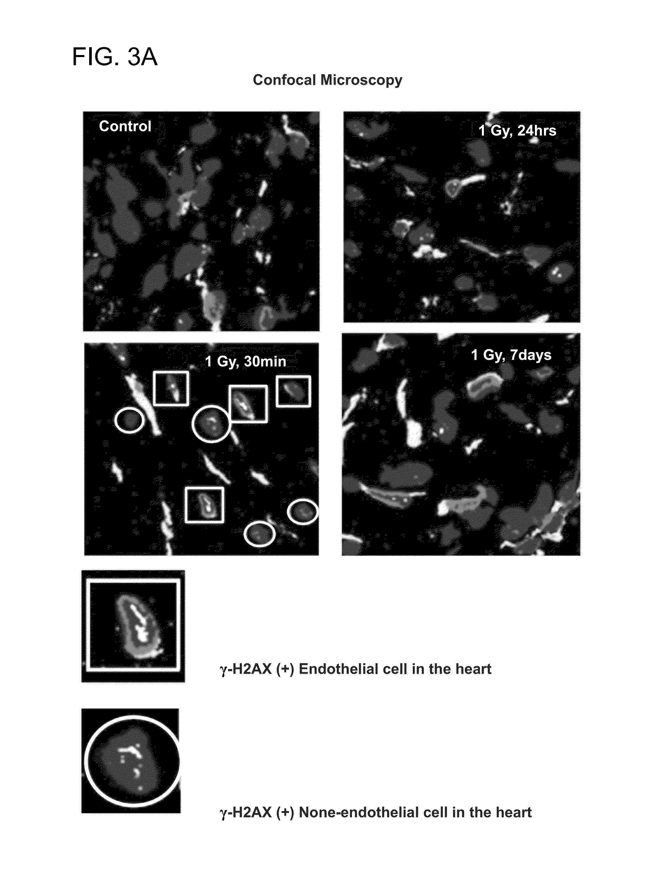 Compositions and methods for the treatment of radiation exposure