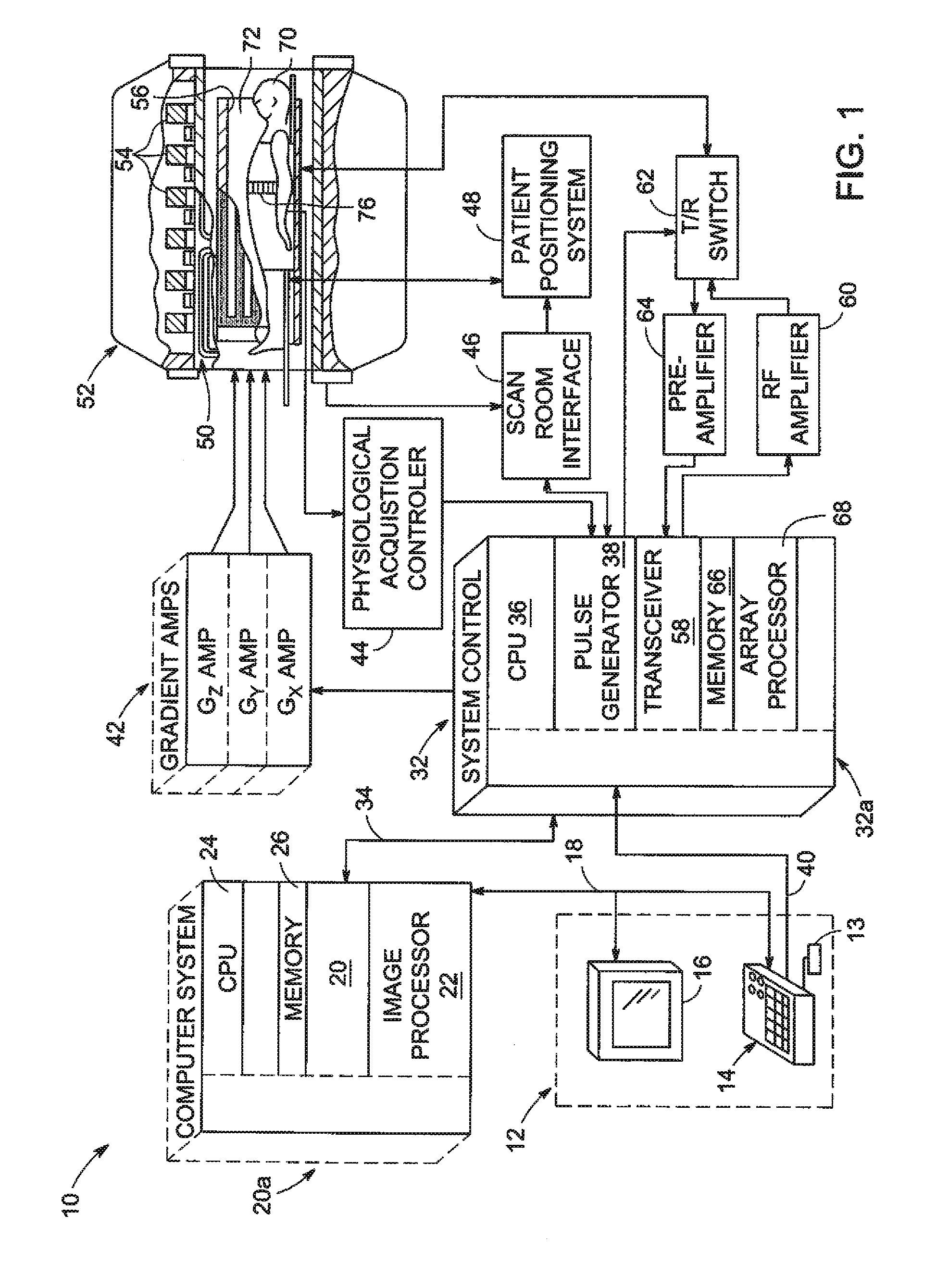 RF coil array for cardiac and thoracic magnetic resonance imaging