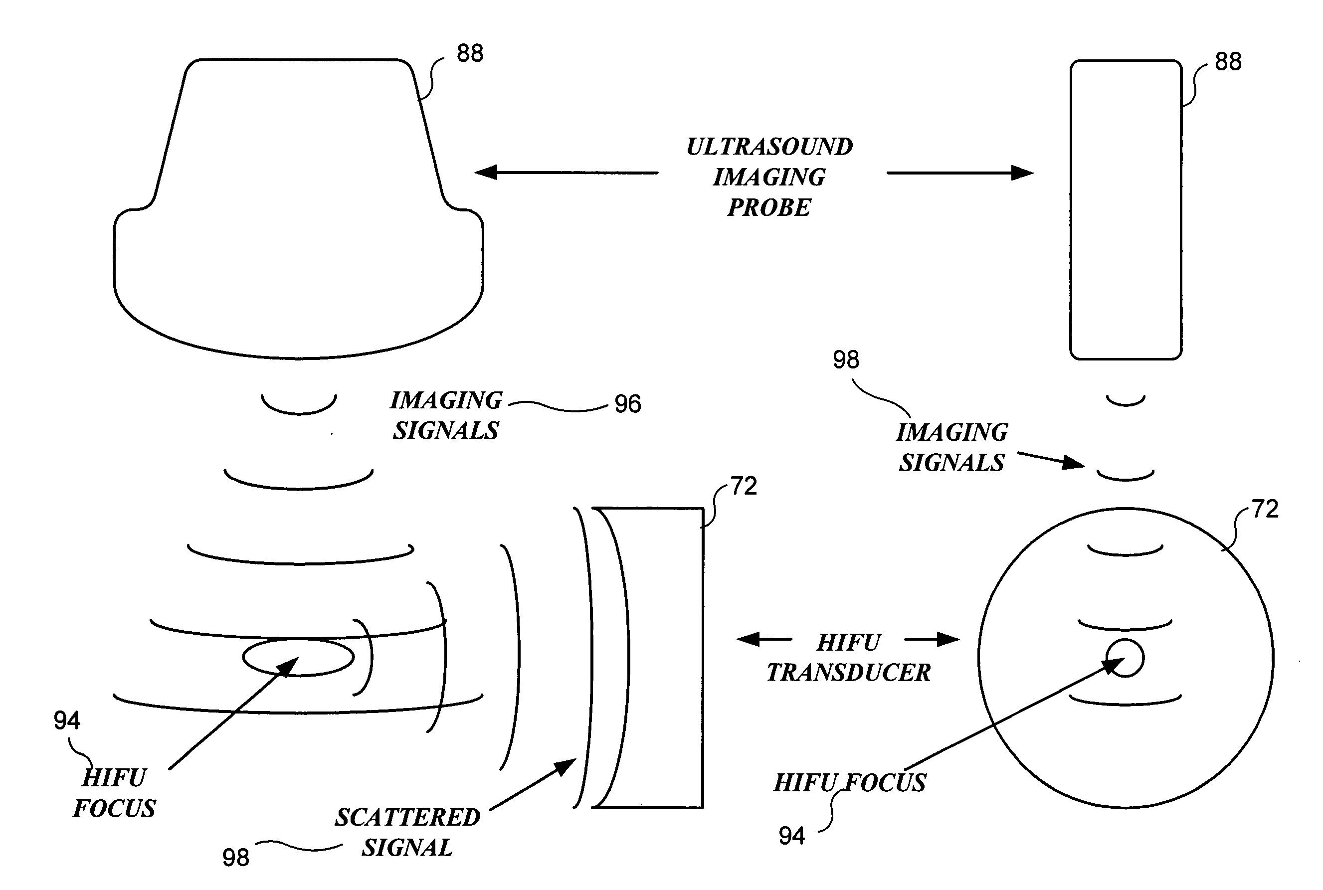 Method and system to synchronize acoustic therapy with ultrasound imaging