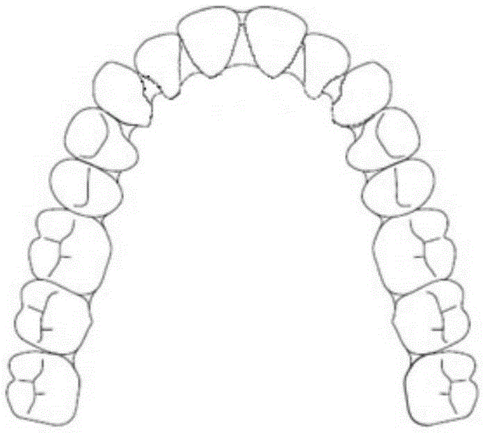 Manufacturing method of invisible tooth correcting treatment devices