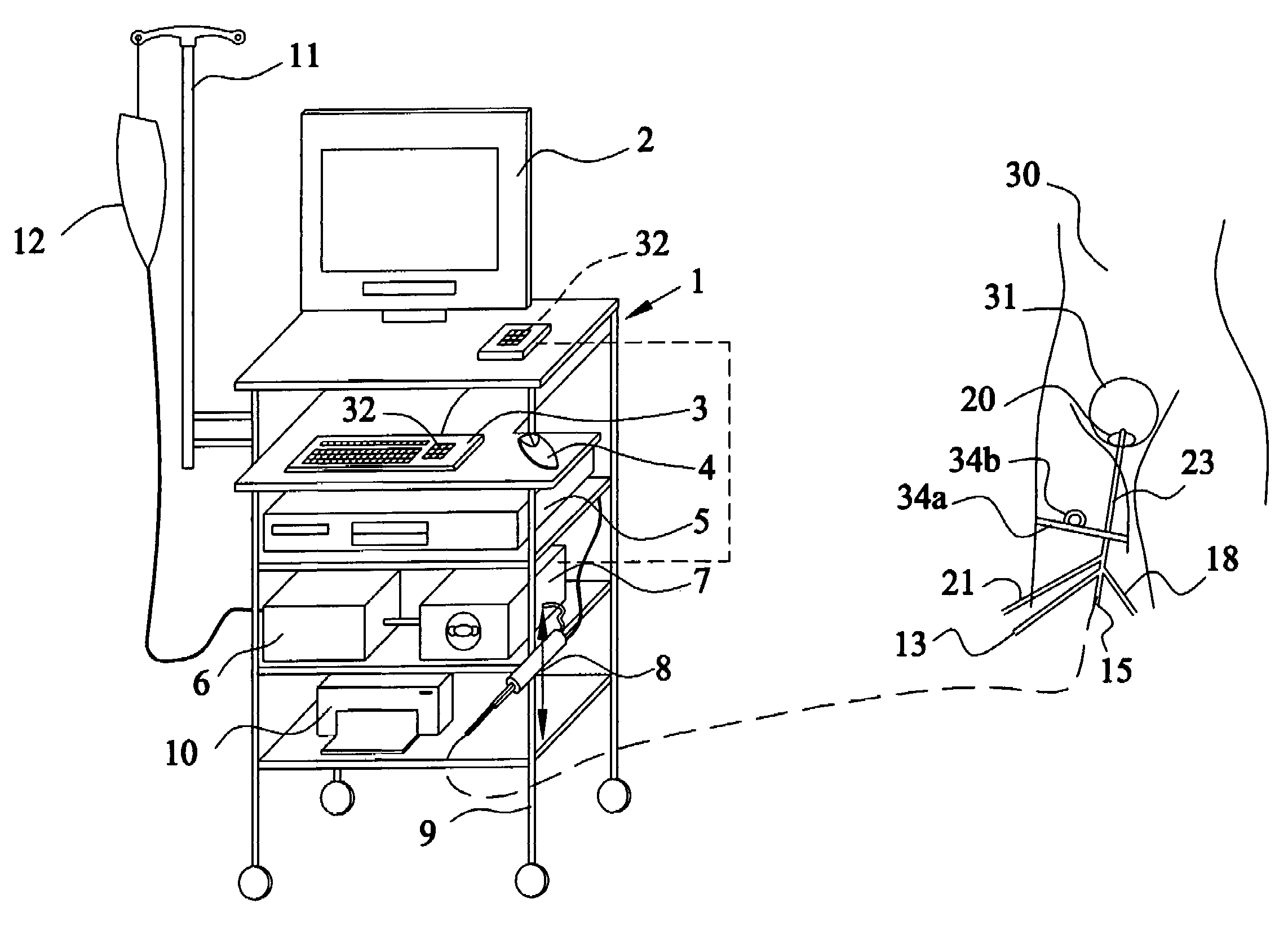 Apparatus and method for the controlled hydrodistention of the urinary bladder