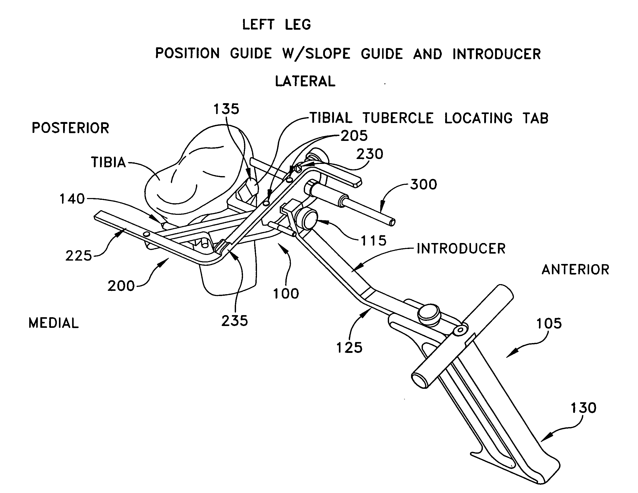 Method and apparatus for performing an open wedge, high tibial osteotomy