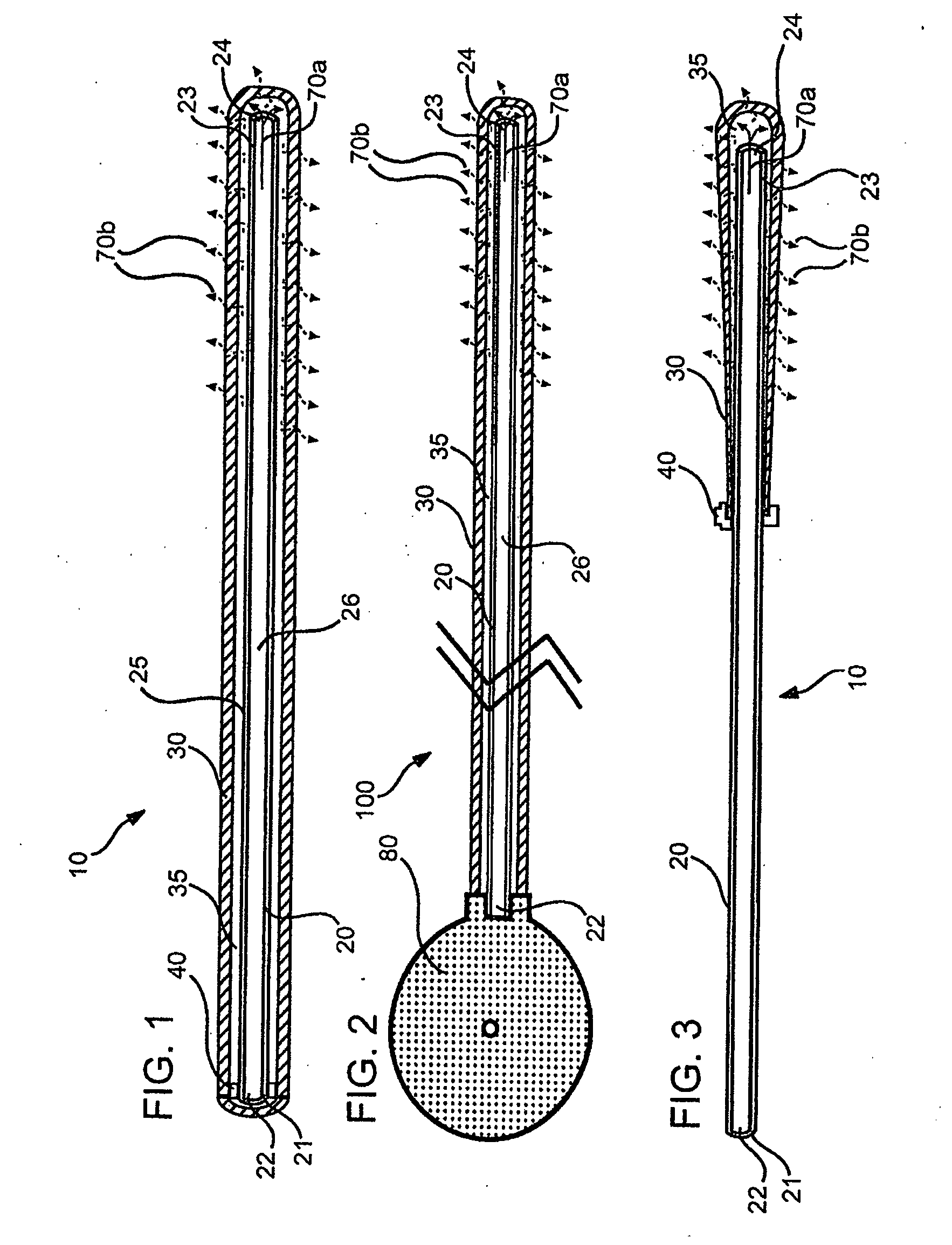 Local concentration management system