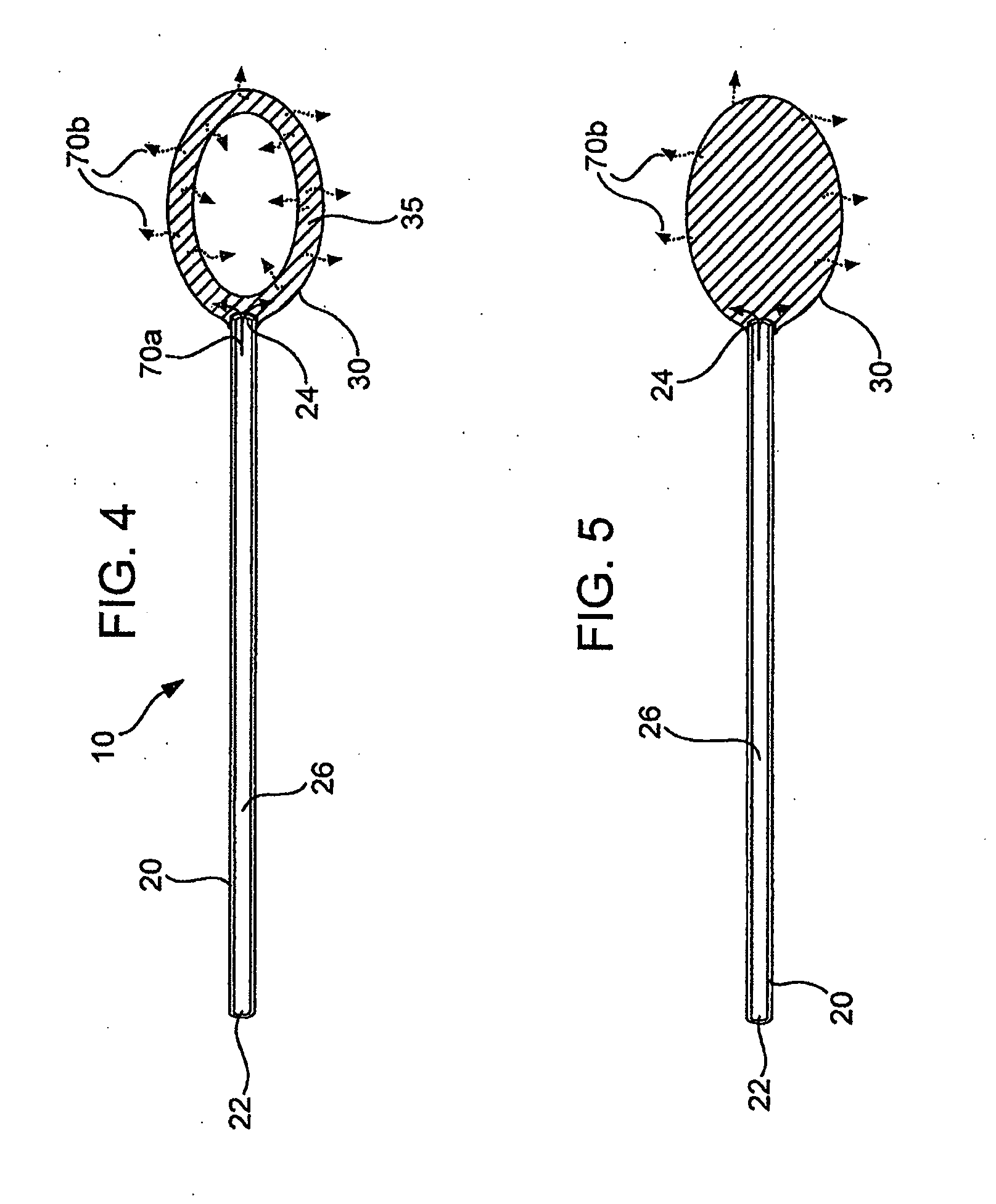 Local concentration management system