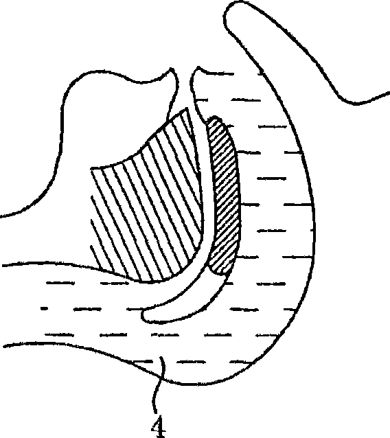 Apparatus for preventing sleeping respiratory disorder