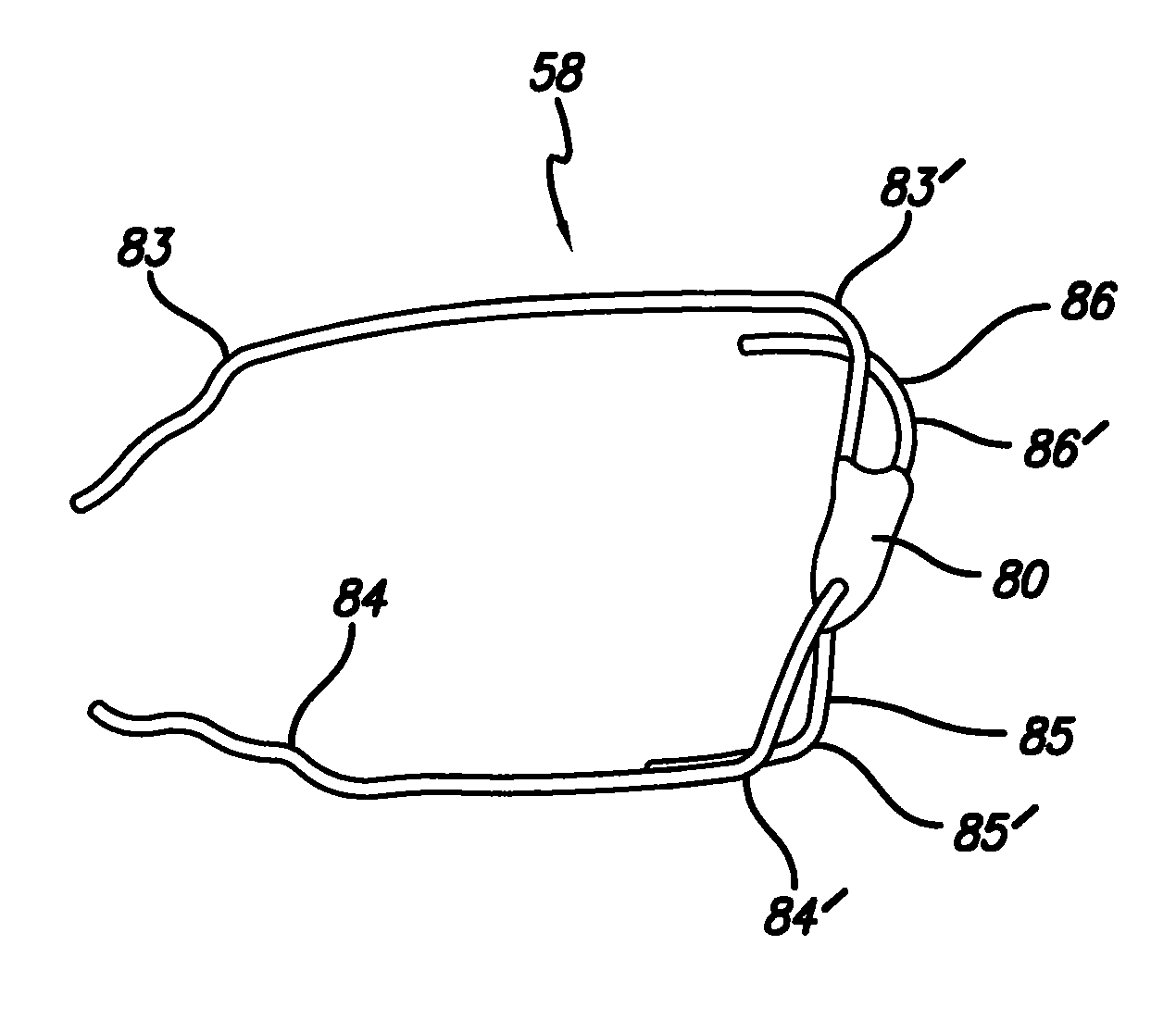 Orthodontic clasp