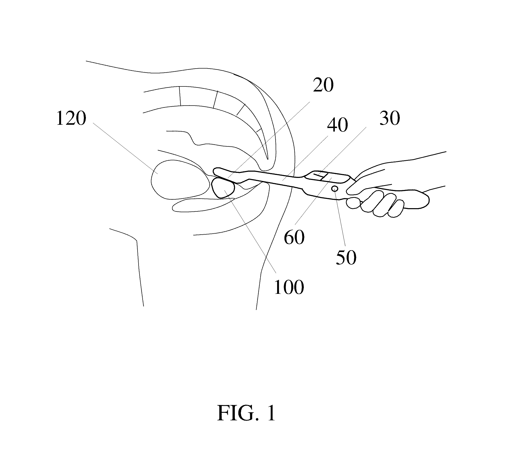 Hand-held probe for prostate cancer screening