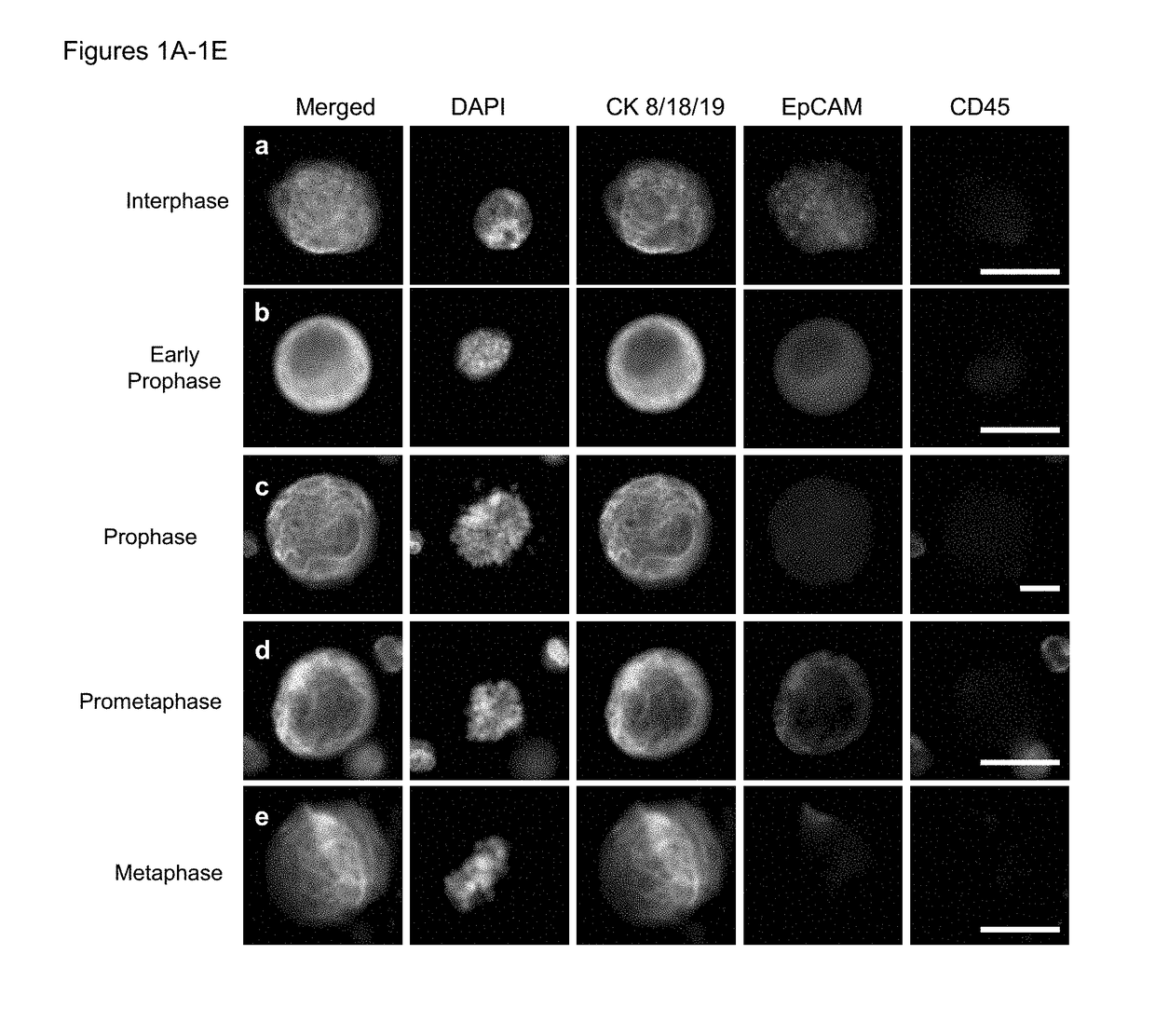 Use of circulating tumor cell mitotic index in cancer stratification and diagnostics