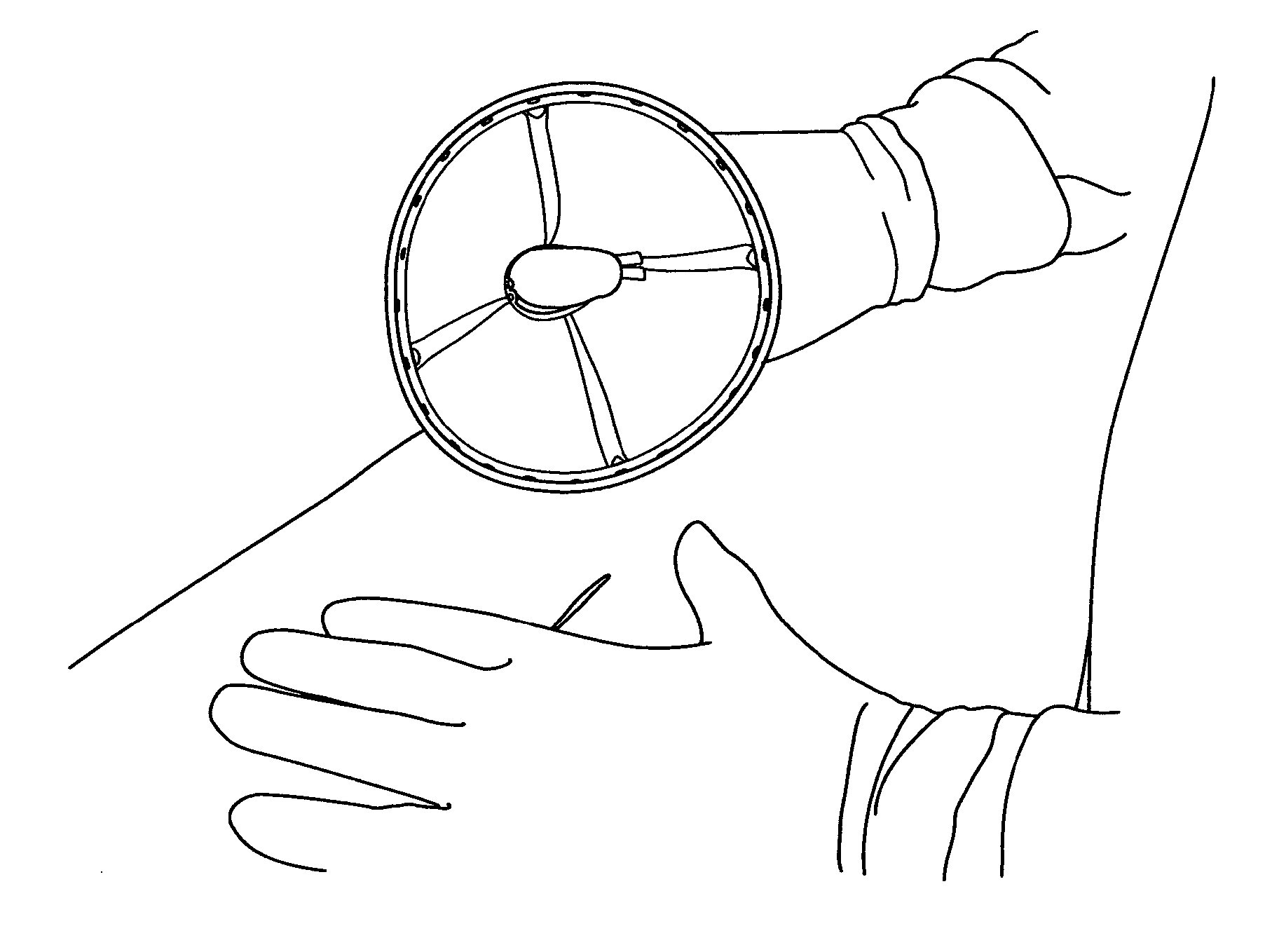 Device Suitable for Use During Deployment of a Medical Device