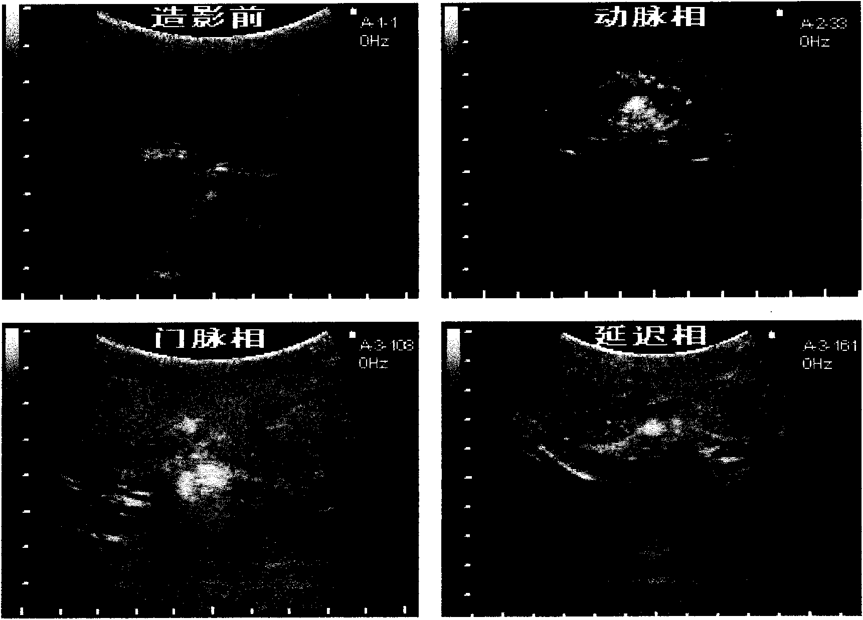 Novel PLGA-PEG-PLGA multipolymer microbubble ultrasound contrast agent and preparation method thereof