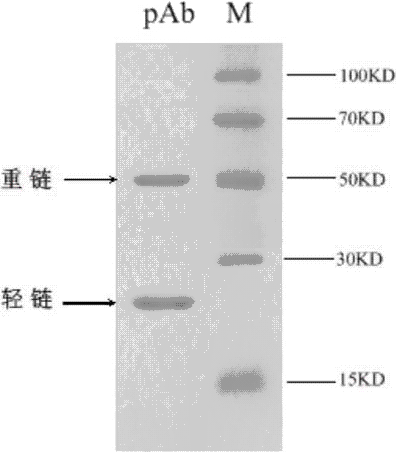 A human procalcitonin immunoassay kit and its preparation method and application