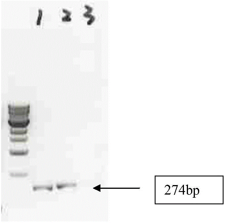 Q-PCR primer, identification method and kit for identifying schistosoma japonicum infected oncomelania