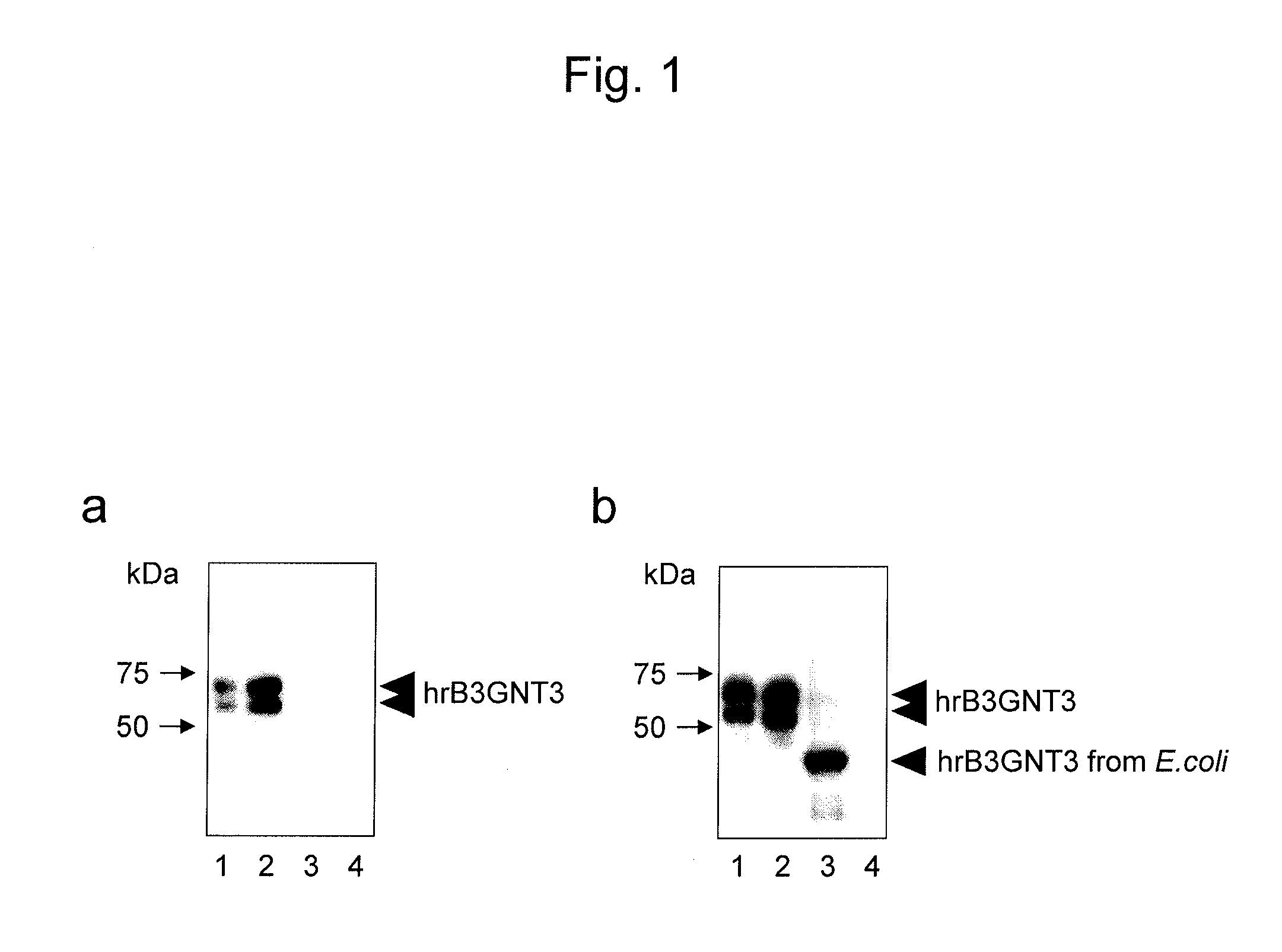 Antibody for detecting epithelial ovarian cancer marker and method for diagnosing epithelial ovarian cancer