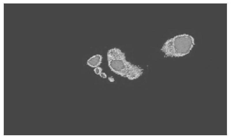 A method for mapping pressure footprint image by optical footprint image