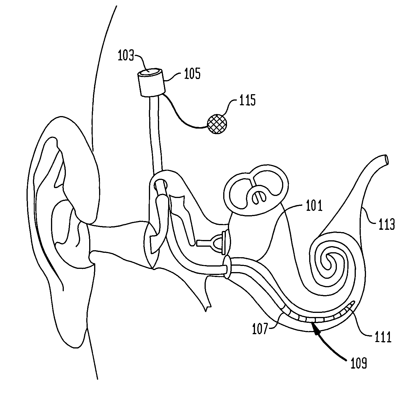 Multirate cochlear stimulation strategy and apparatus