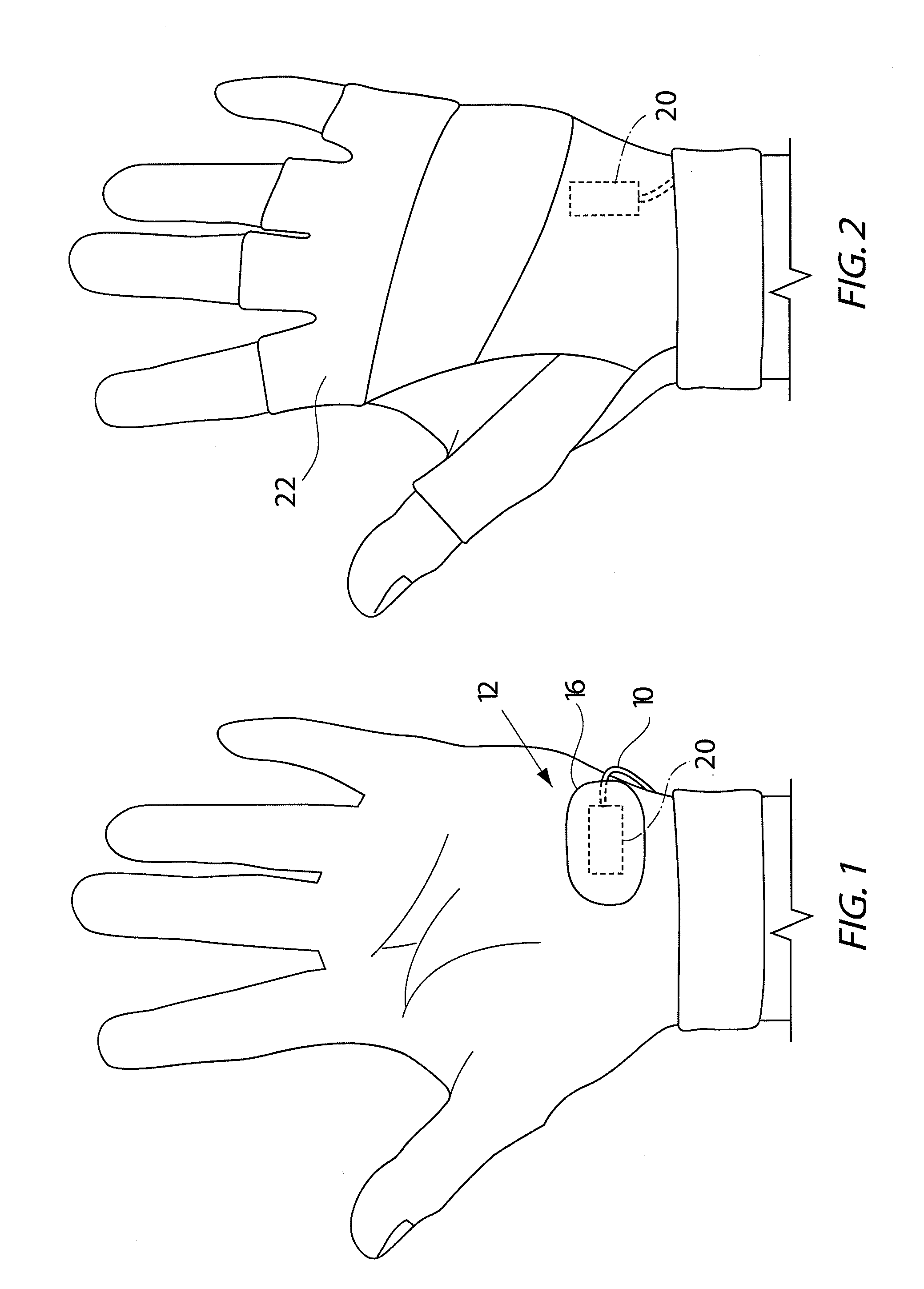 Hypothenar sensor