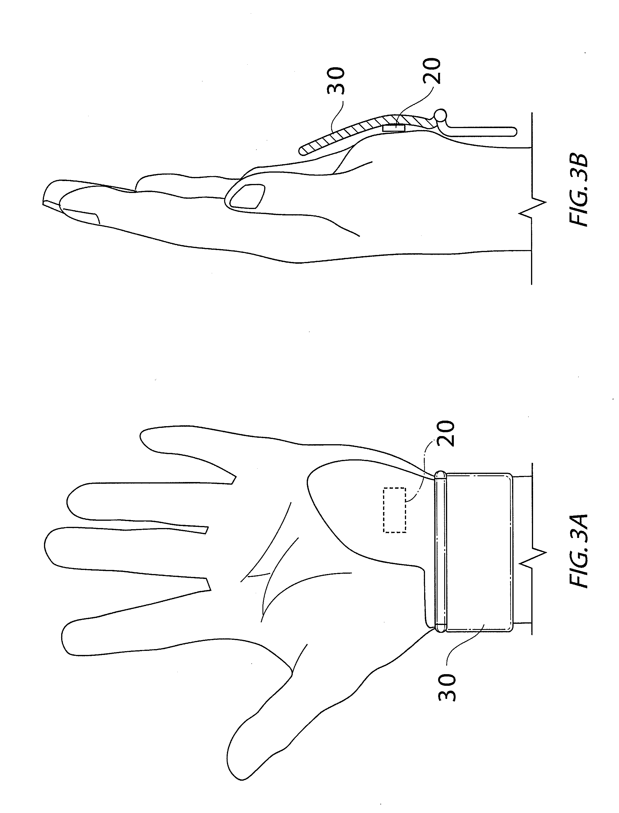 Hypothenar sensor